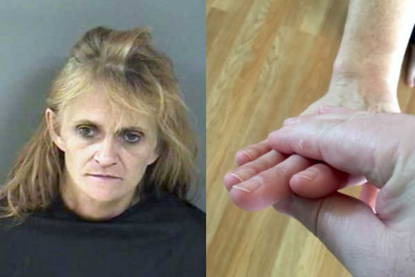 Woman calls police after her friend bends her fingers back in Vero Beach.